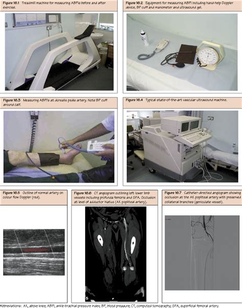 Abdominal Aortic Aneurysm II: Treatment | Thoracic Key