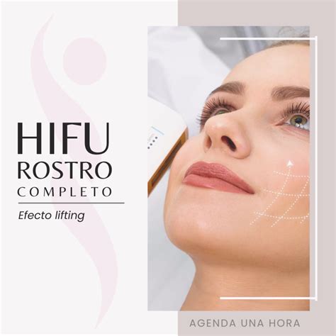 Hifu Rostro Completo Con Definici N Mandibular Cl Nica Est Tica