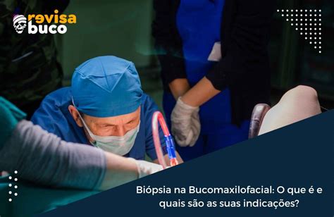 Biópsia na Bucomaxilofacial O que é e quais são as suas indicações