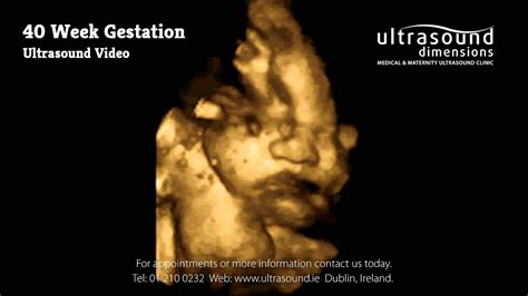 Pregnancy Ultrasound Image Gallery 25 32 Weeks, 55% OFF