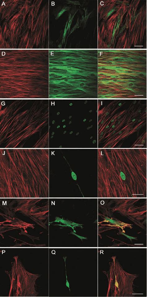 Spontaneous Expression Of Neural Markers By Undifferentiated HMSCs P4