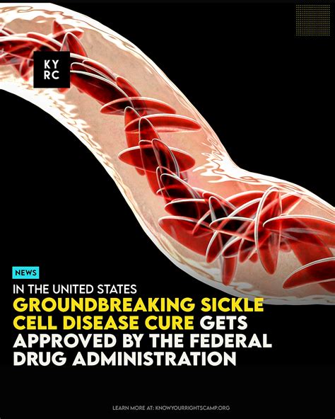 Groundbreaking Sickle Cell Disease Cure Gets Approved By The Federal Drug Administration