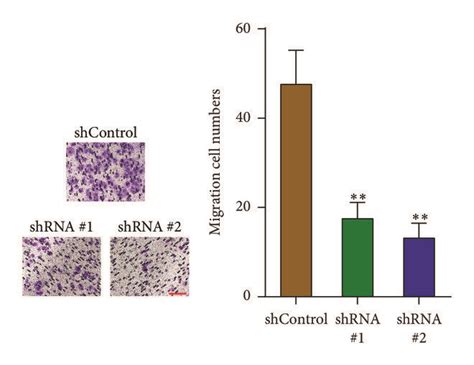 Depletion Of PVT1 Inhibits Melanoma Cells Proliferation Cell Cycle