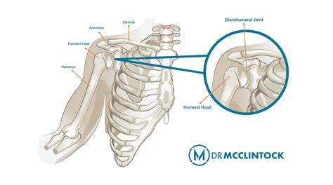 What Is A Slap Repair Kyle Mcclintock Do Orthopedic Surgeon