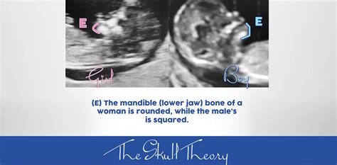 The Skull Theory - The Physical Attributes of your Baby's Skull Matter ...