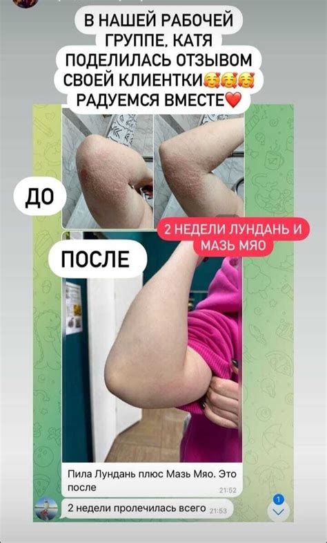 Лундань и мазь МЯО