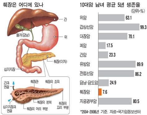 췌장암1기 2기 3기 4기 생존율 네이버 블로그