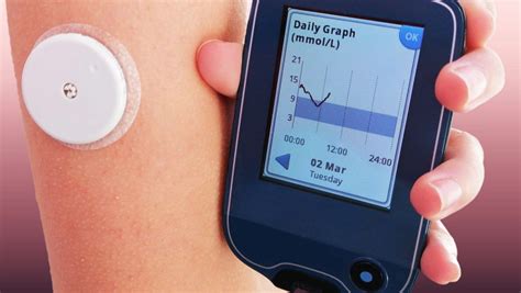 Introduction to Continuous Glucose Monitoring Devices | Times Square ...