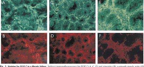 Figure From Basic Fibroblast Growth Factor Expression Is Increased In