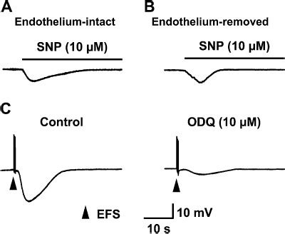 Action Of The No Donor Snp And Effect Of The Gc Inhibitor Odq On