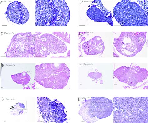 Histology Sections Of Mouse Ovaries At Different Ages All Bars