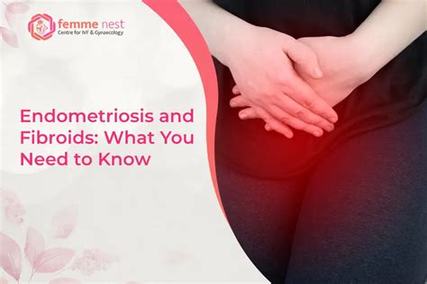 Endometriosis And Fibroids What You Need To Know