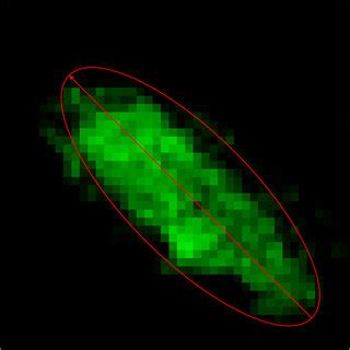 Retinal Whole Mount Immunostaining Of Microglial Cells At Different