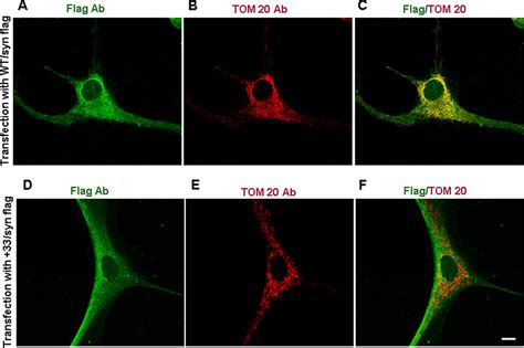 Mitochondrial Import And Accumulation Of Synuclein Impair Complex I