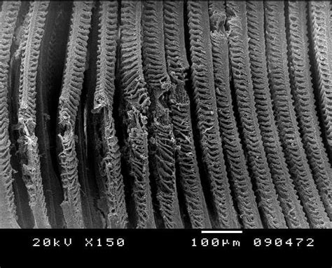 Low Power Scanning Electron Micrograph Showing The Architecture Of The