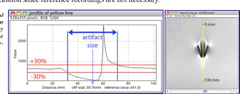 Figure 1 From Software Development For The Determination Of Susceptibility Artefacts In Mri