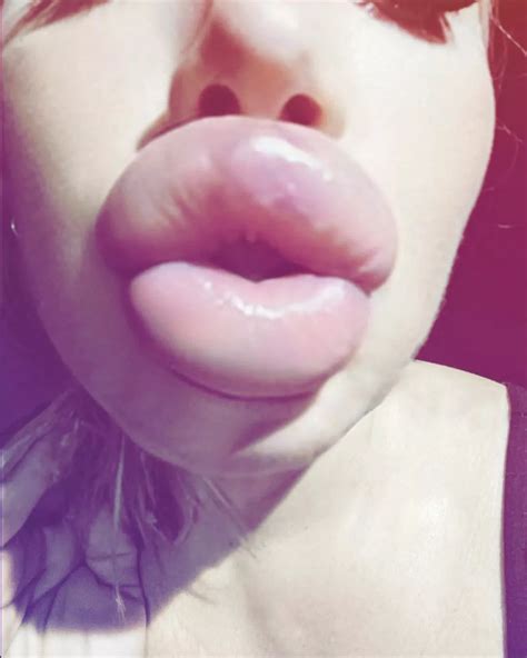 Swollen Up Close Nudes Boltedonlips NUDE PICS ORG