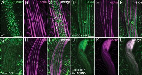 Cofilin Mediated Actin Dynamics Promotes Actin Bundle Formation During