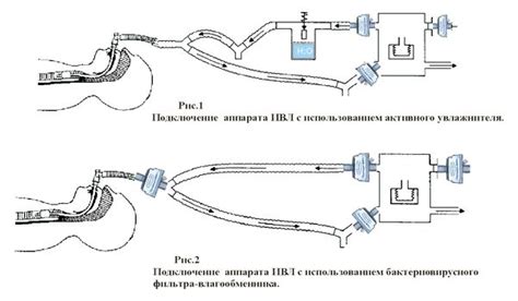 Термовент дыхательный «ГЕПА» PORTEX | Новый Мир - официальный ...