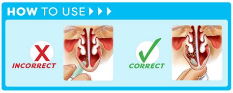 Flo Rapid Relief Decongestant Flo By Ent Technologies