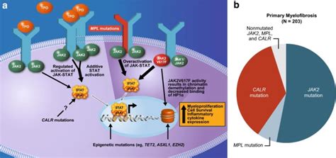 Primary Myelofibrosis | Concise Medical Knowledge