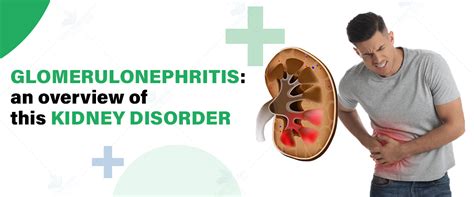 glomerulonephritis  overview   kidney disorder