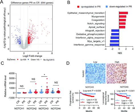 Notch Is Aberrantly Highly Expressed In Chemoresistance Npc Patients