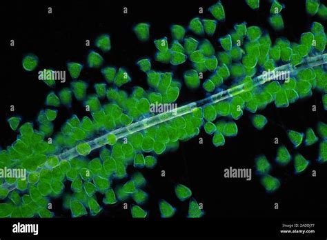 Vorticella Protozoa Darkfield Illuminated Polarised Light Micrograph