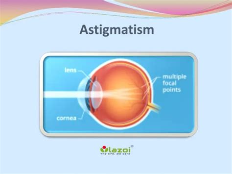 PPT - SEM Lens Aberration: Astigmatism PowerPoint Presentation, free ...