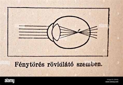 Chirurgie ophtalmologique Fotos und Bildmaterial in hoher Auflösung