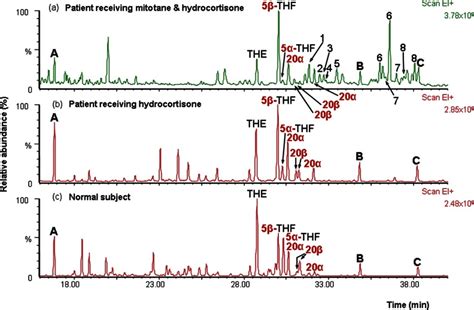 Total Ion Current Chromatograms From Gcms Analysis Of Urinary Steroid