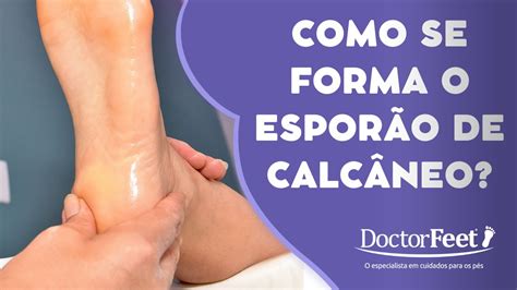 Como Se Forma O Espor O De Calc Neo Doctor Feet Podologia