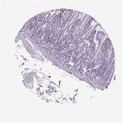 Tissue Expression Of Cd68 Staining In Small Intestine The Human