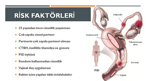 Pelvik Inflamatuar Hastalık Prof Dr Başak Baksu