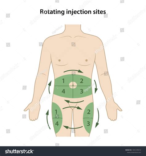 Diabetes Circle Injection Sites Shown On Stock Vector (Royalty Free ...