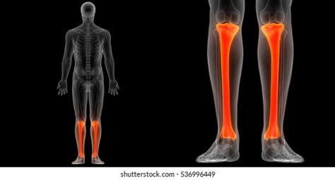 Human Body Bone Joint Pains Tibia Stock Illustration 536996458 ...