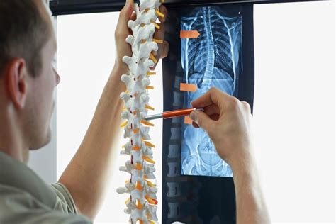 Spinal Stabilization Treatment And Cost Guide