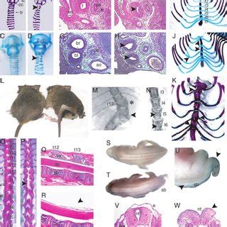 Schematic location of neural tube closure sites and neuropores ...