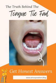 30 Tongue Tie ideas | tongue tie, tongue, myofunctional therapy