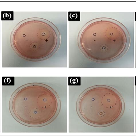 Decolorization Zones Of Experimental Materials In The Agar Diffusion