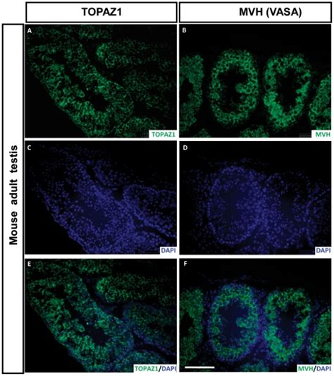 Immunofluorescence Was Performed On Sections Of Mouse Adult Testis To