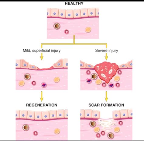 Four Stages Of Tissue Repair Flashcards Quizlet