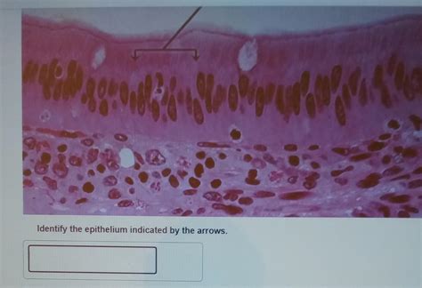 Solved Identify The Epithelium Indicated By The Arrows Chegg