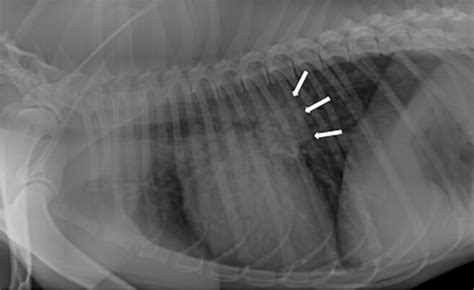 Blastomycosis Lung X Ray