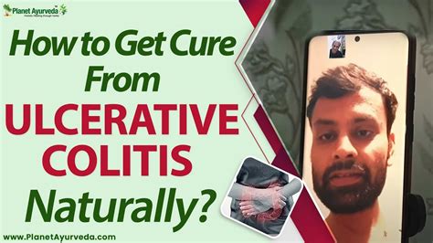 How To Get Cure From Ulcerative Colitis Naturally Youtube