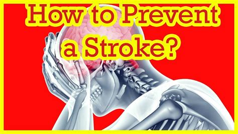 How To Prevent A Stroke What Can You Do To Prevent Stroke Youtube