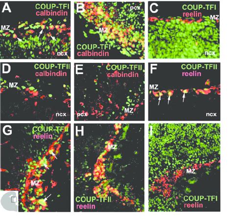 COUP-TFI is expressed in GABAergic interneurons, while COUP-TFII is ... 