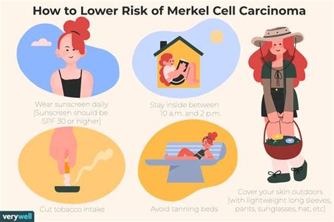 Causes Et Facteurs De Risque Du Carcinome Cellules De Merkel Fmedic