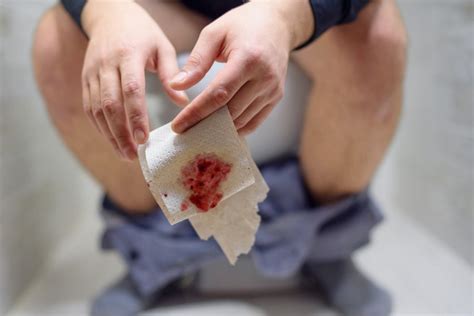 What Can Blood on Toilet Paper but Not on Stool Mean? » Scary Symptoms