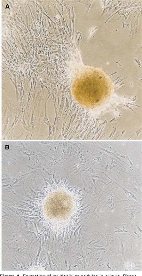 Figure From Calcification Of Human Vascular Cells In Vitro Is